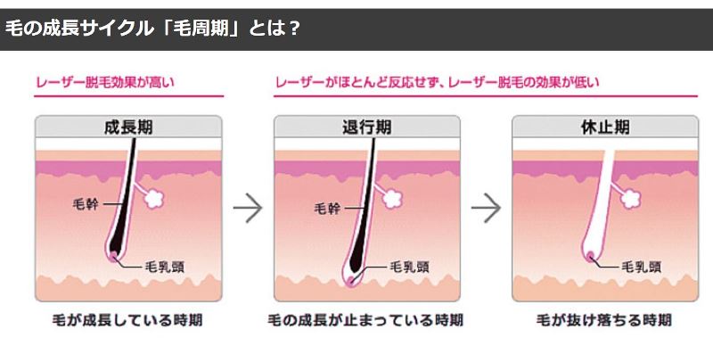 毛の成長サイクル「毛周期」の3つのフェーズ「成長期」「後退期」「休止期」