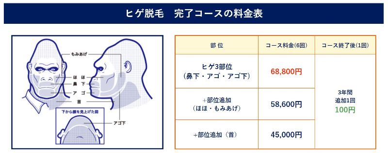 ゴリラクリニックのヒゲ脱毛の料金表