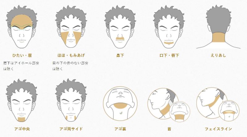 メンズTBCで選択できる髭脱毛箇所