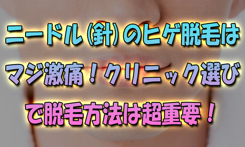 ニードル(針)ヒゲ脱毛はマジ激痛！クリニック選びで脱毛方法は超重要だから！