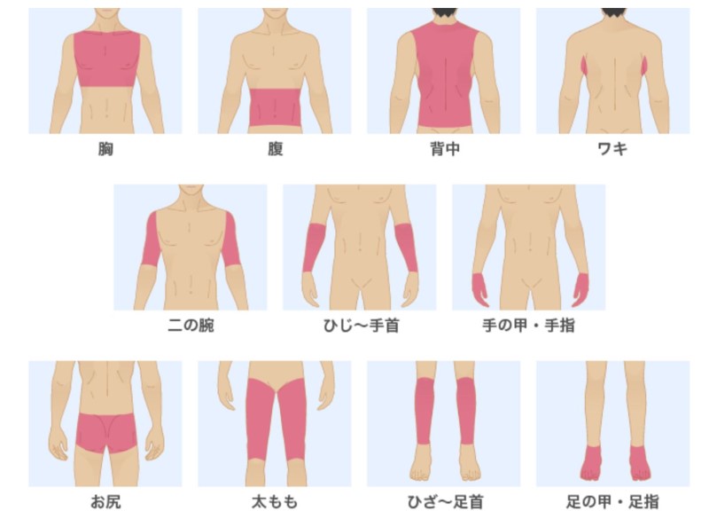 メンズリゼの全身脱毛の部位はここまで