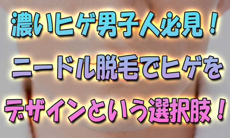 濃い人必見！ニードル脱毛でデザインヒゲにするという選択肢